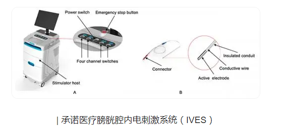 承诺医疗推出UAB创新治疗系统（IVES），填补行业空白