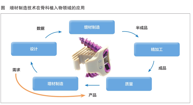 增材制造让骨科植入物定制化梦想成真