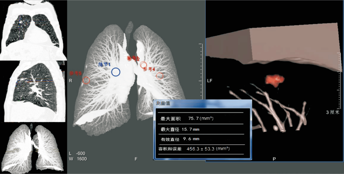 博为软件肺部医学影像AI辅助诊断系统，获湖南省专项资金支持